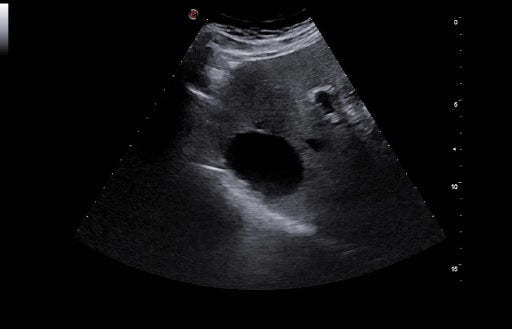 échographie mylab A50