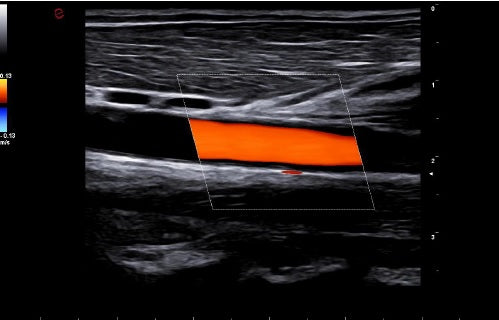 échographie mylab A50