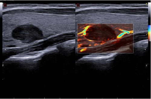 échographie mylab A50