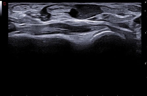 échographie mylab A50