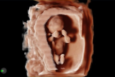 échographie mylab A50