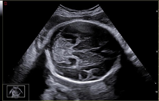 échographie mylab A50