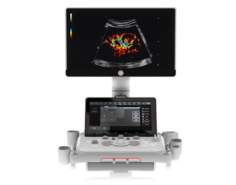 échographe MyLab A50 ESAOTE
