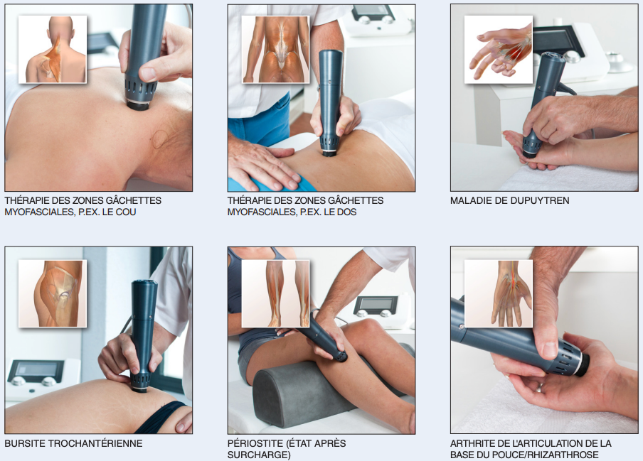PACK Ondes de chocs Endopuls 811 + 1 pièce à main supplémentaire - ENRAF-NONIUS