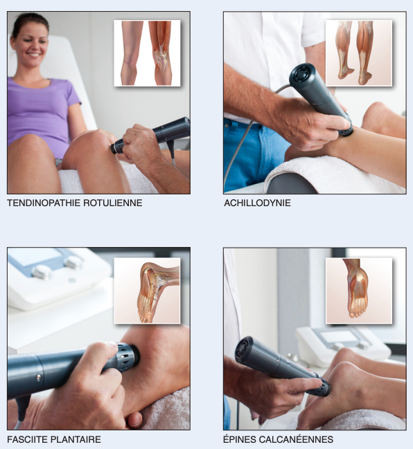 PACK Ondes de chocs Endopuls 811 + 1 pièce à main supplémentaire - ENRAF-NONIUS