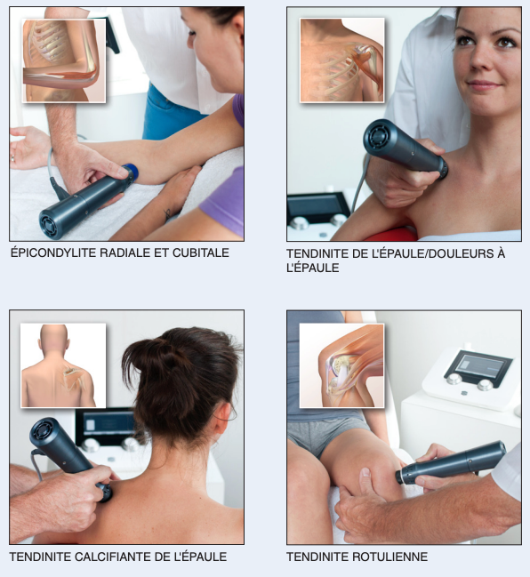 PACK Ondes de chocs Endopuls 811 + 1 pièce à main supplémentaire - ENRAF-NONIUS