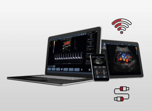 Échographe portable sans fil Q7 Esaote