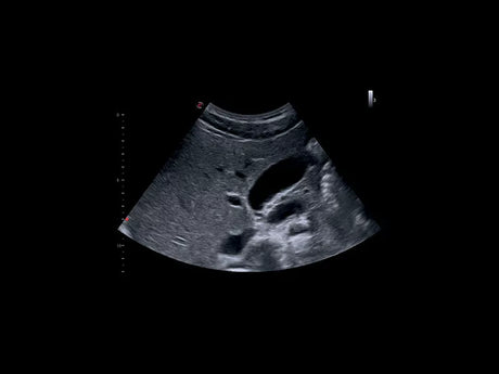 Echographie MyLab™X1 Esaote