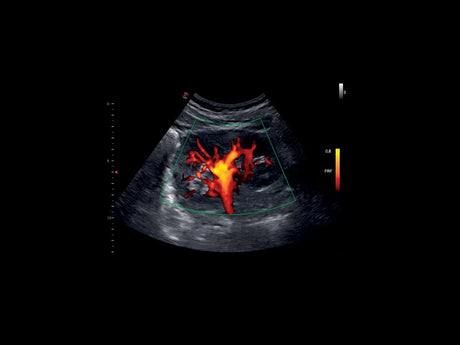Echographie MyLab™X1 Esaote