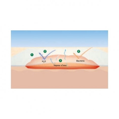 schema supraborb film