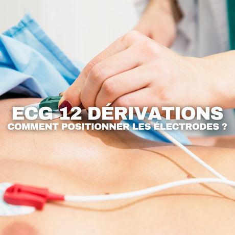 Comment placer les électrodes d’un ECG 12 dérivations ? Guide professionnel