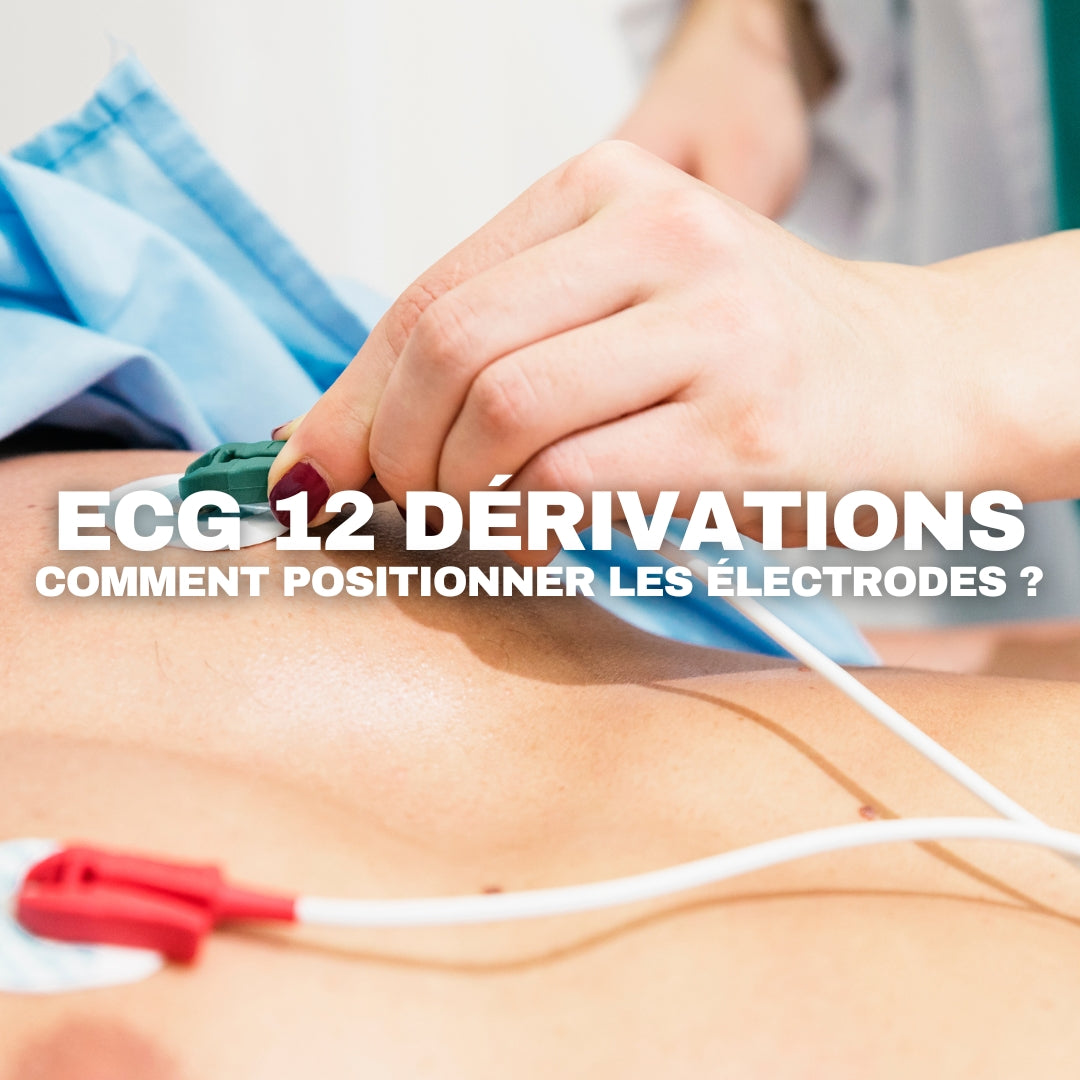 Comment placer les électrodes d’un ECG 12 dérivations ? Guide professionnel