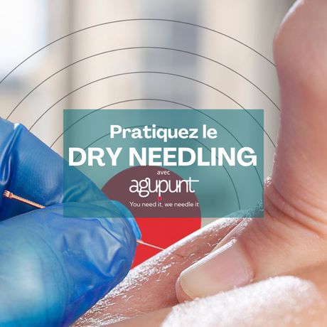 Dry Needling : une technique efficace pour soulager les douleurs myofasciales