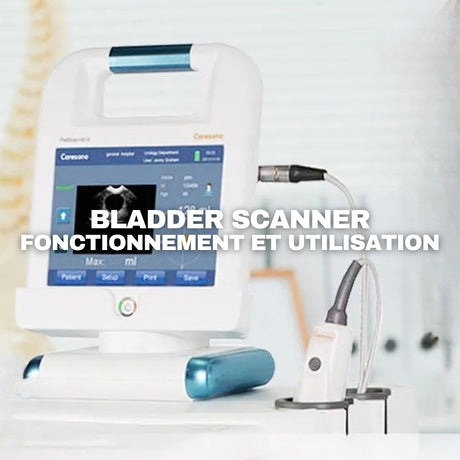 Tout savoir sur le bladder scanner : fonctionnement et indications d’utilisation