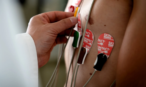 Électrodes, Adaptateurs & Pinces