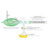 Circuit respiratoire pour administration O2/N2O - Kit MEOPA