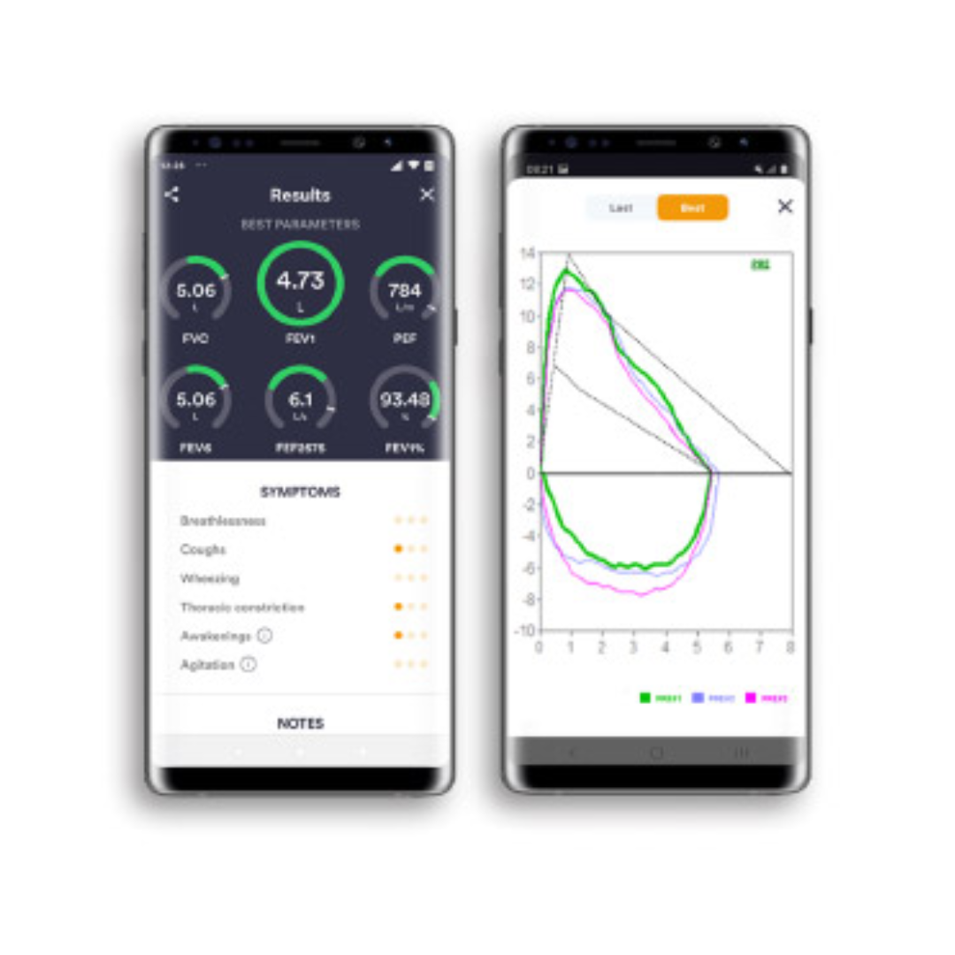 Spiromètre Spirobank Smart - MIR