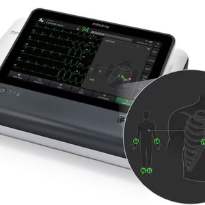 ECG et Papiers ECG